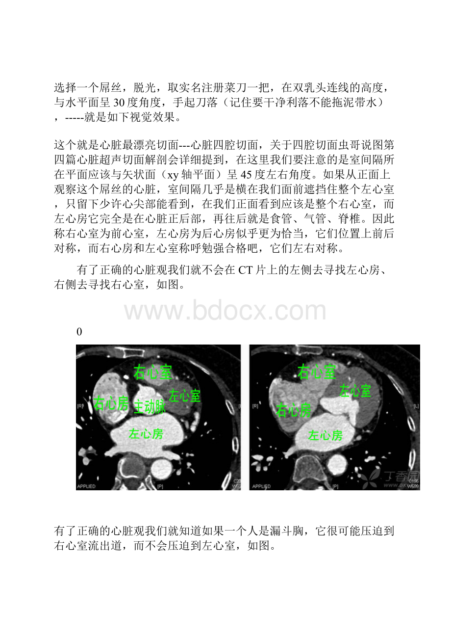 心脏解剖.docx_第3页