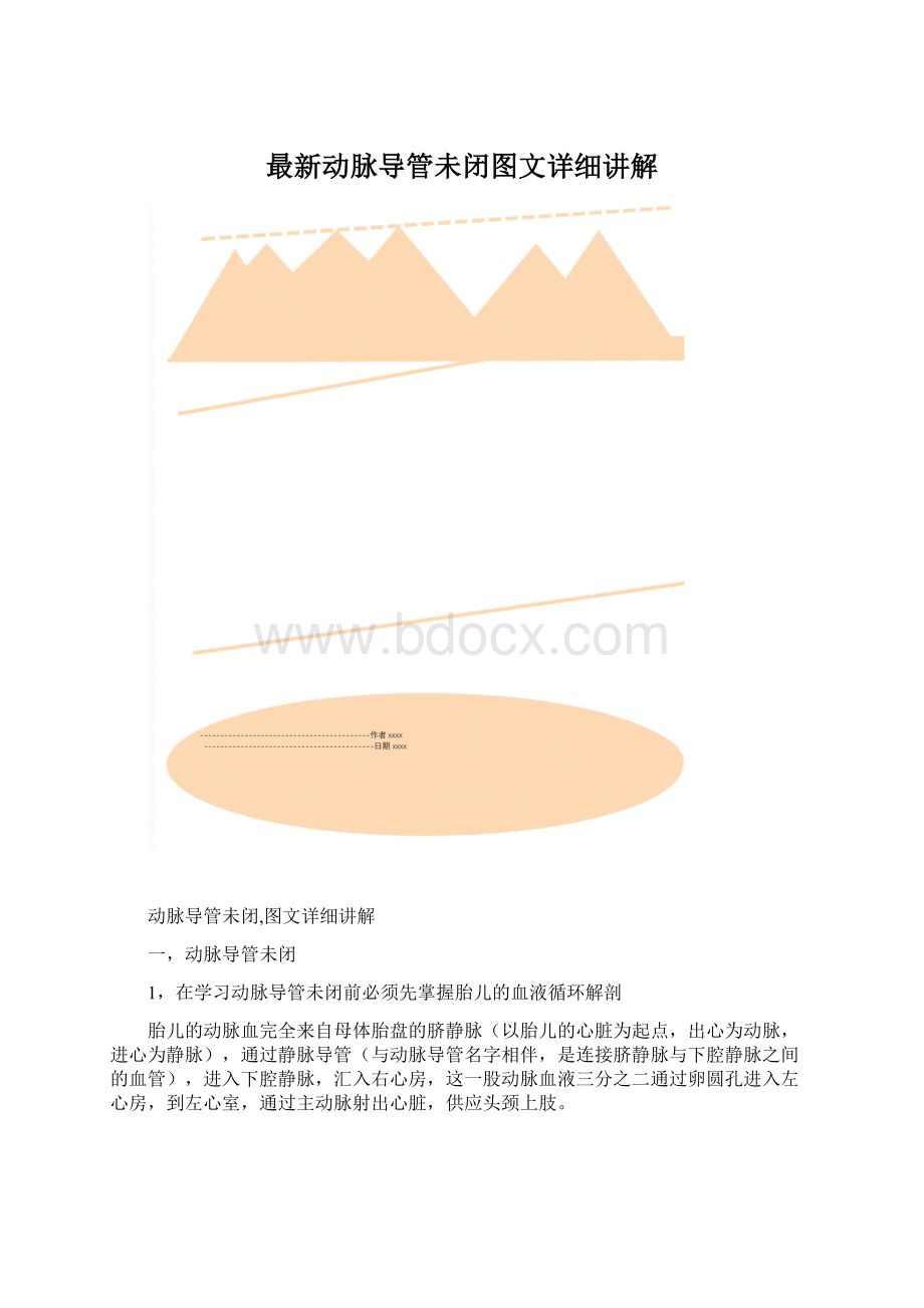 最新动脉导管未闭图文详细讲解.docx_第1页