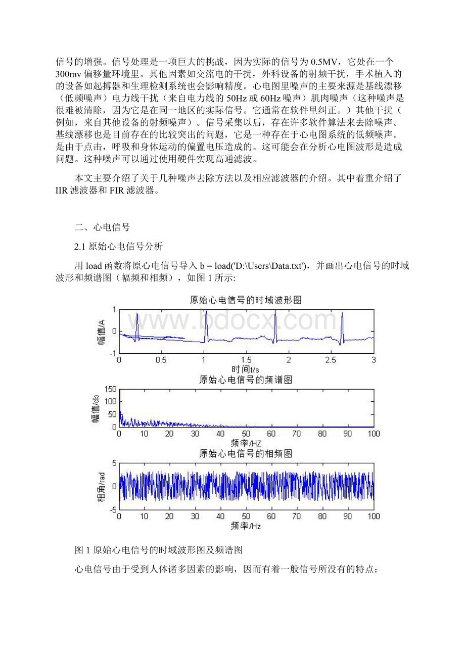 ECG信号分析与处理系统设计.docx_第3页