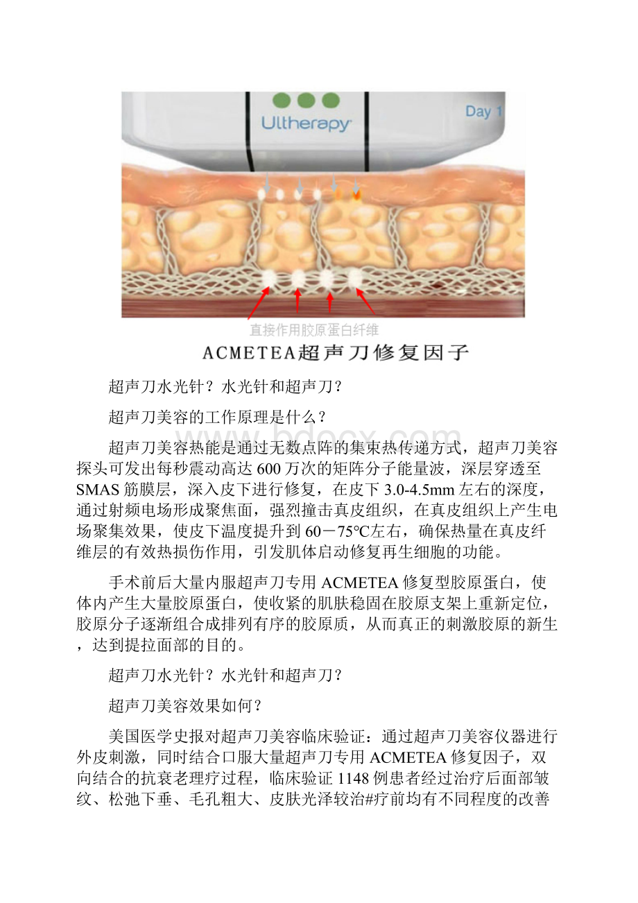 超声刀水光针水光针和超声刀汇编.docx_第2页