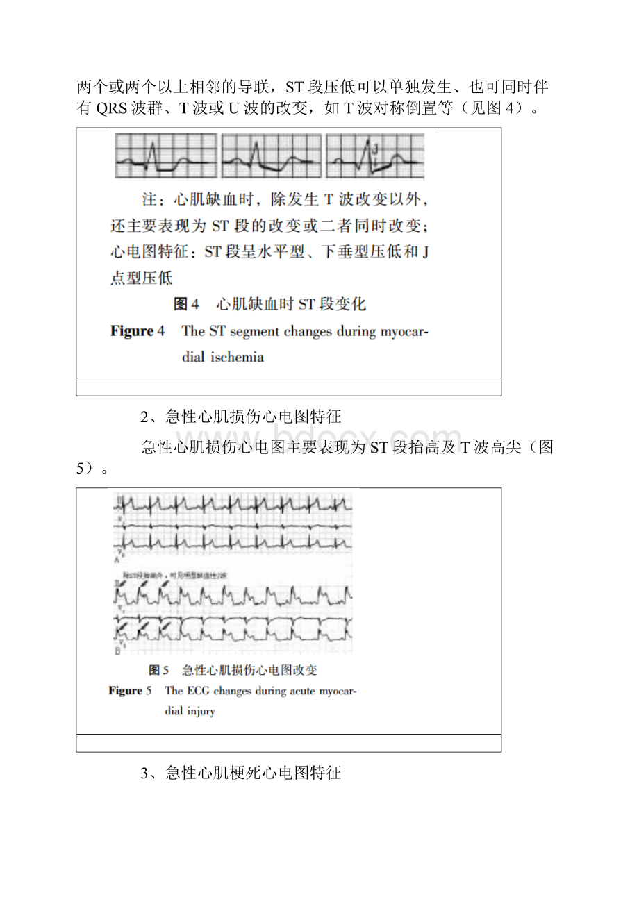 详解临床常见心电图危急值识别.docx_第3页