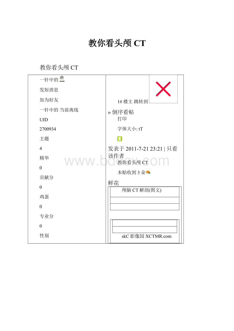教你看头颅CT.docx