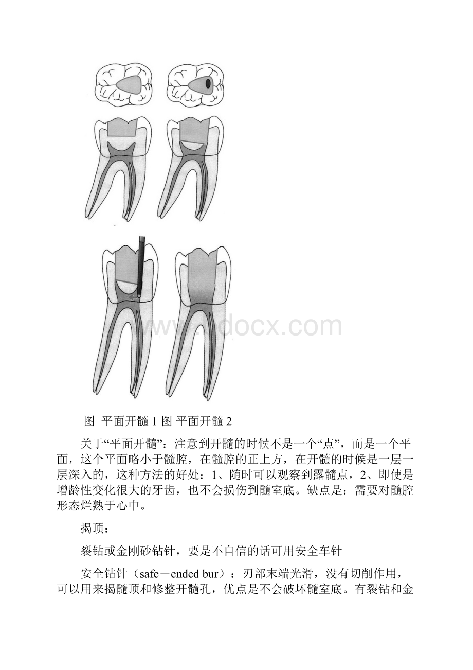 根管治疗器械的选择.docx_第2页