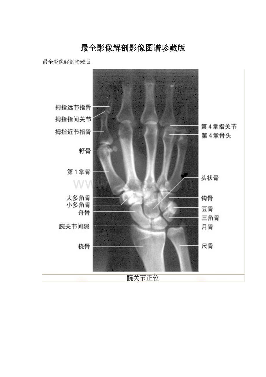 最全影像解剖影像图谱珍藏版.docx