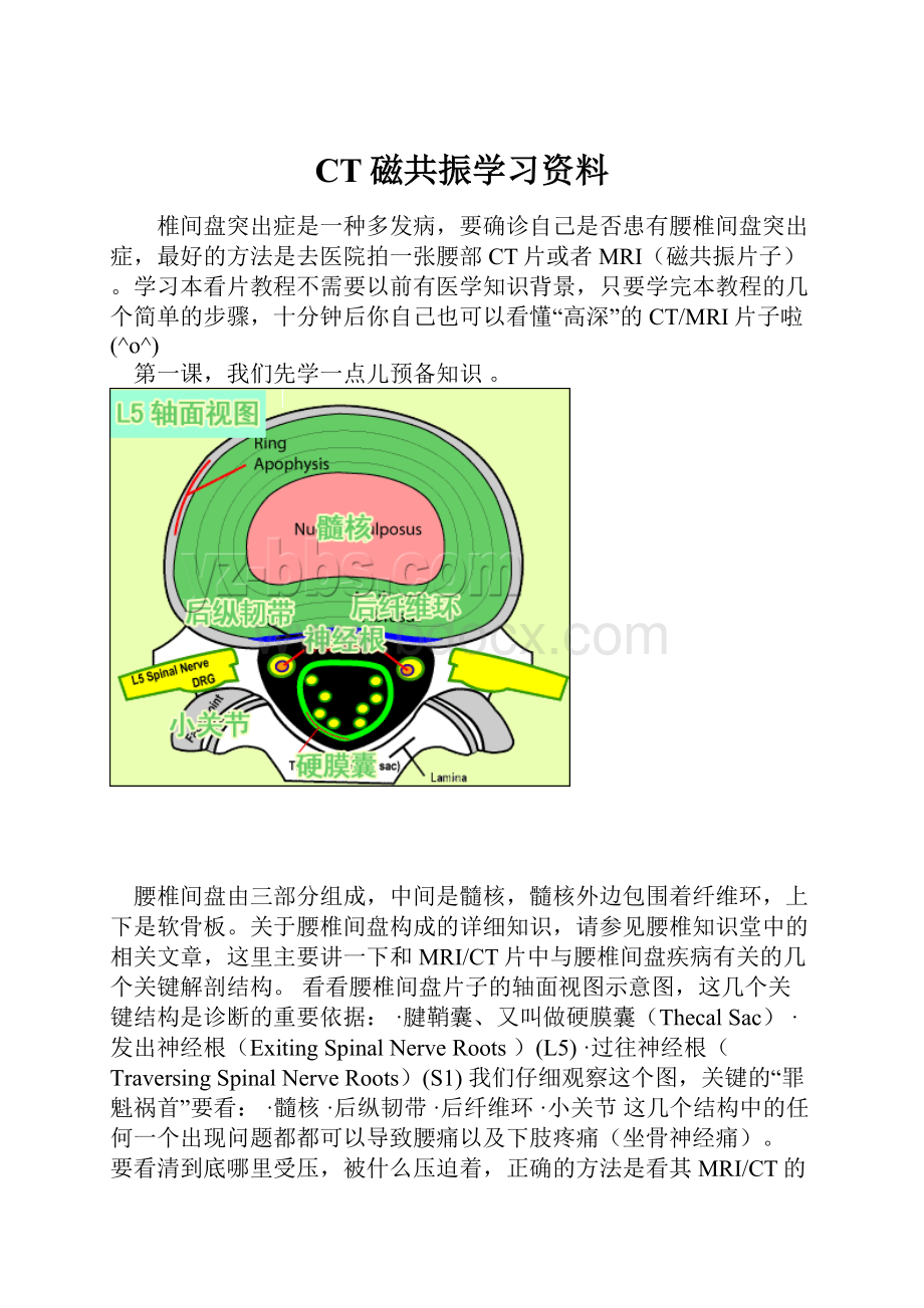 CT磁共振学习资料.docx_第1页