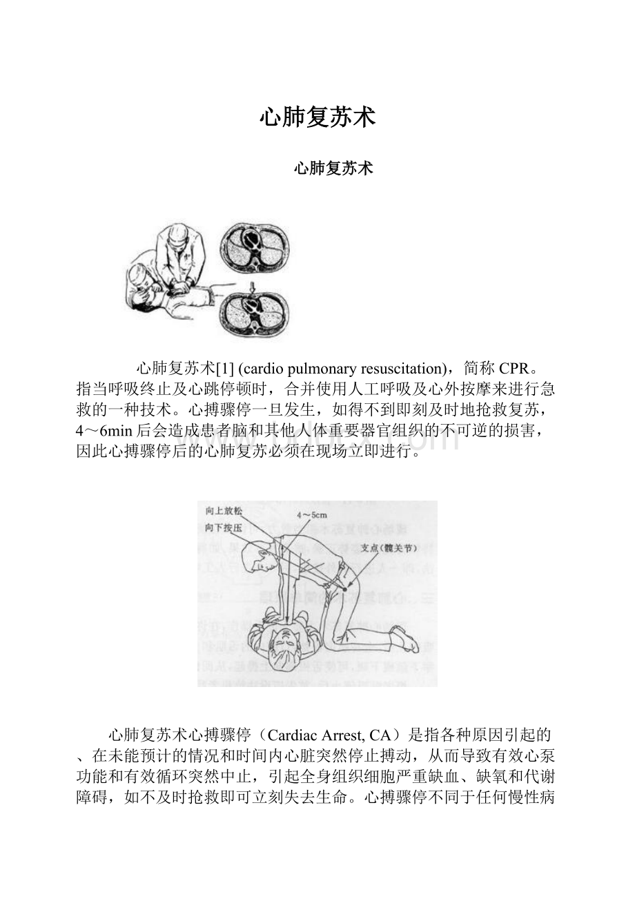 心肺复苏术Word格式文档下载.docx