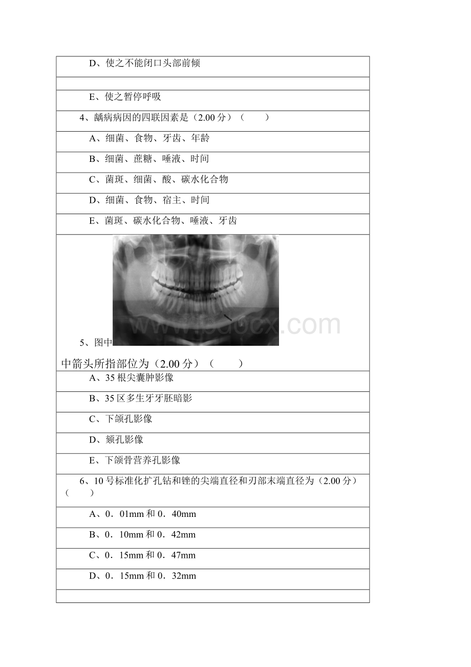 牙体牙髓科出科考试1.docx_第2页