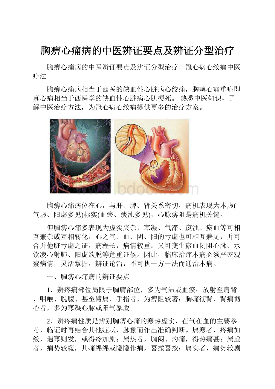 胸痹心痛病的中医辨证要点及辨证分型治疗.docx