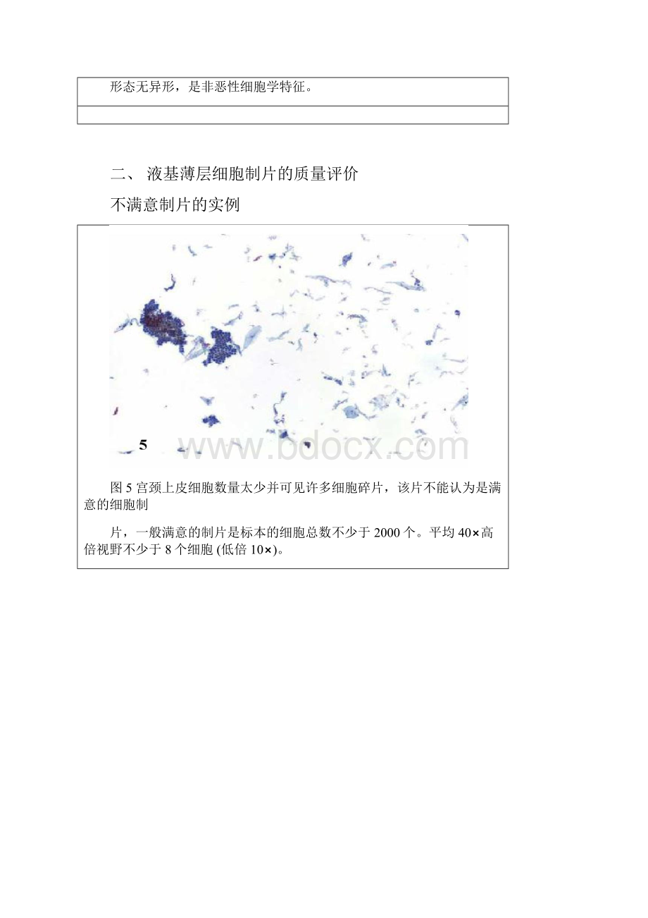 整理图谱宫颈细胞学.docx_第3页