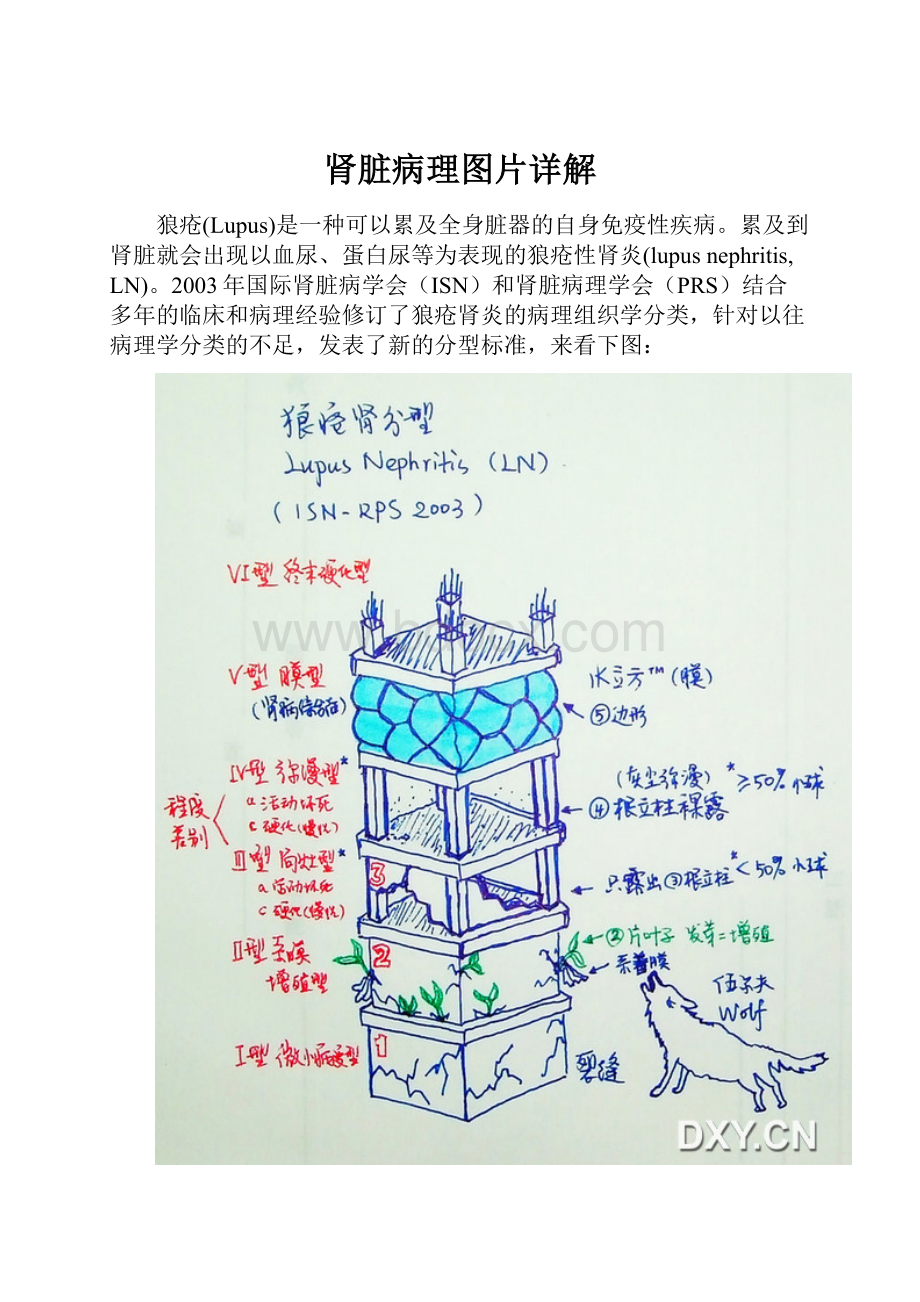 肾脏病理图片详解.docx_第1页