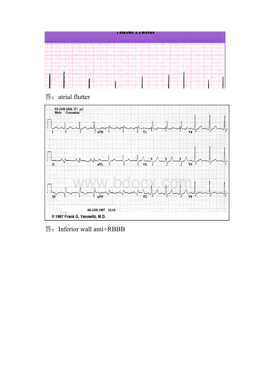 心电图知识讲座提纲2.docx_第2页
