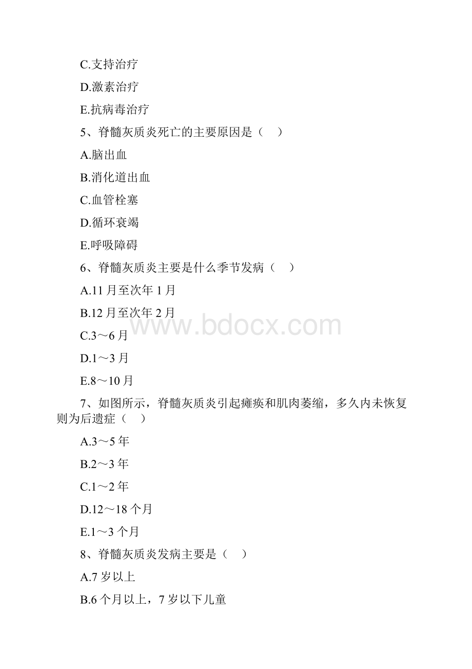 传染病学高级职称题脊髓灰质炎.docx_第2页