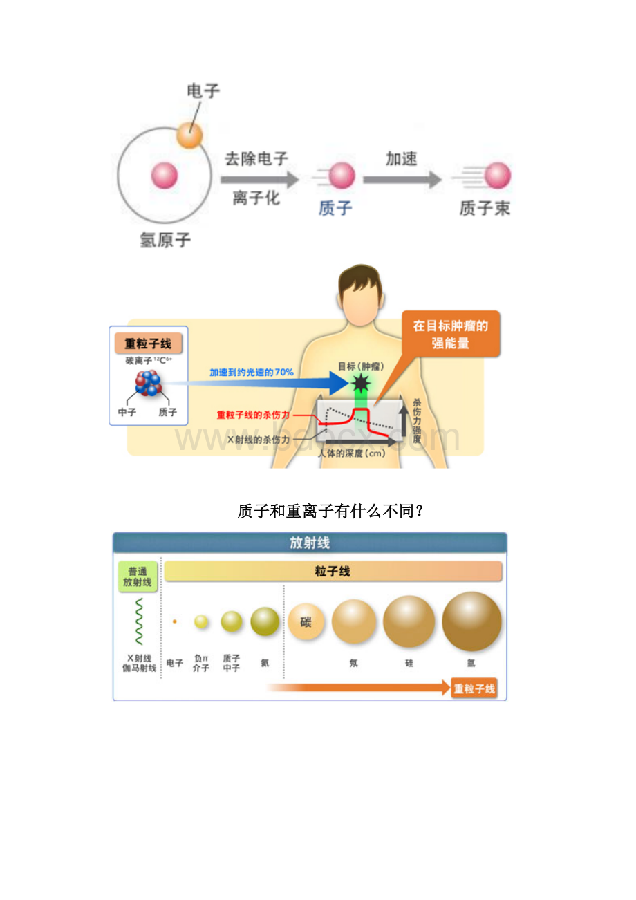 质子重离子治疗是癌症的终极克星.docx_第2页