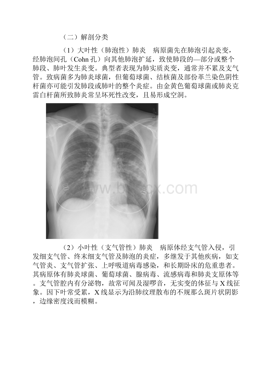 呼吸系统疾病5肺炎.docx_第2页