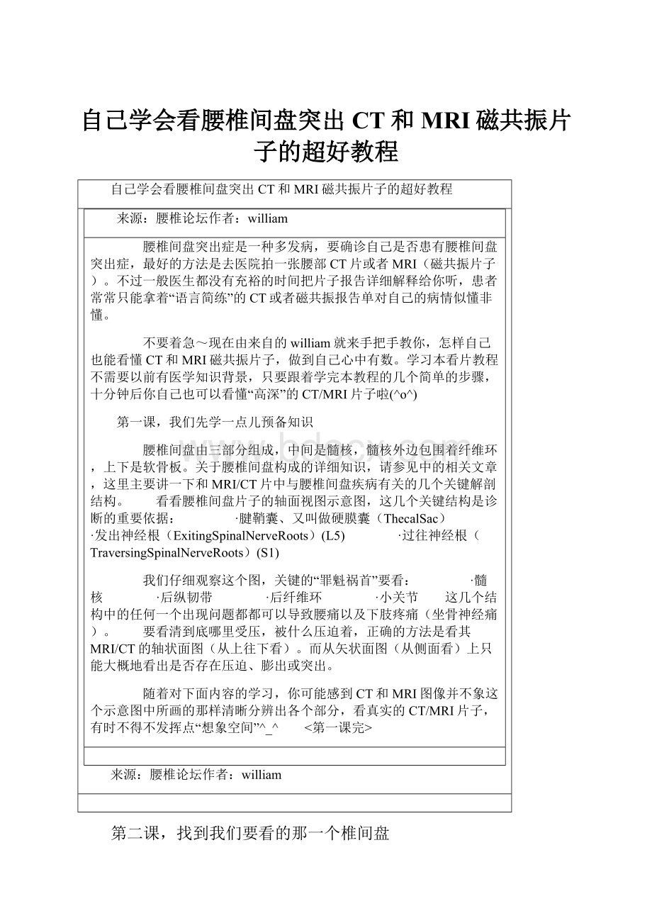 自己学会看腰椎间盘突出CT和MRI磁共振片子的超好教程.docx_第1页