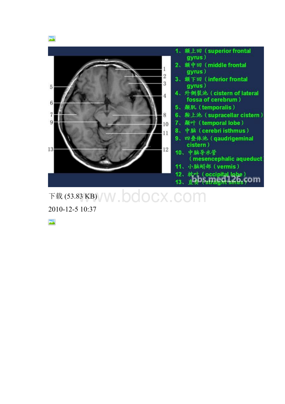 MRI影像解剖.docx_第3页