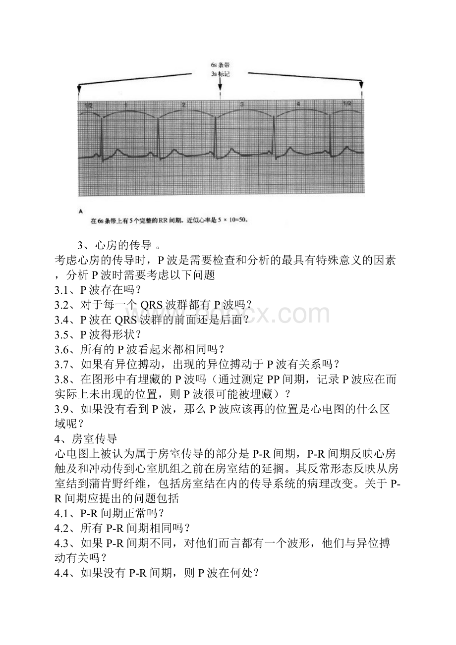 心电图详解.docx_第2页