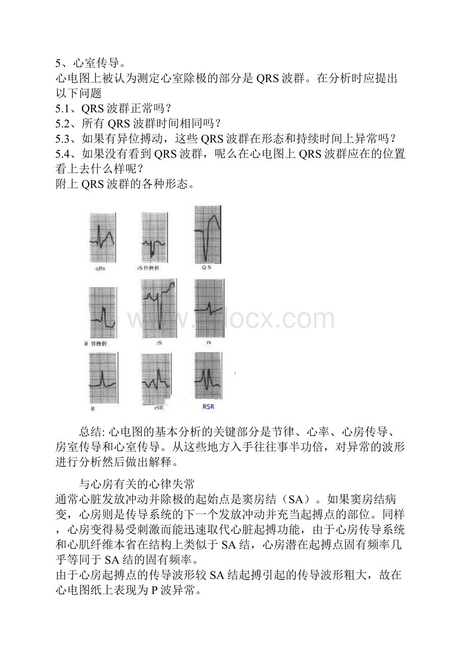 心电图详解.docx_第3页