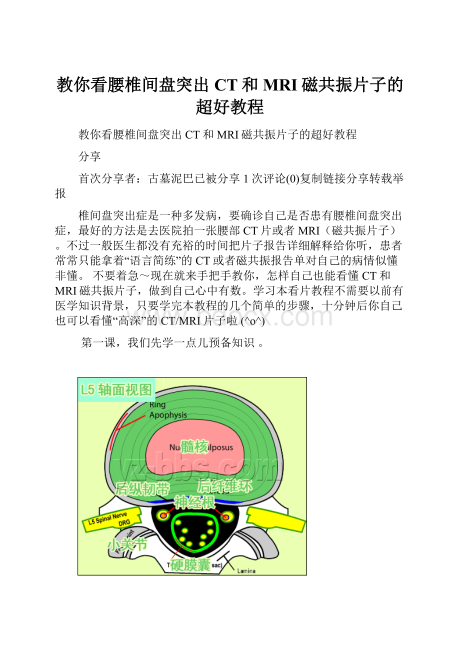 教你看腰椎间盘突出CT和MRI磁共振片子的超好教程.docx