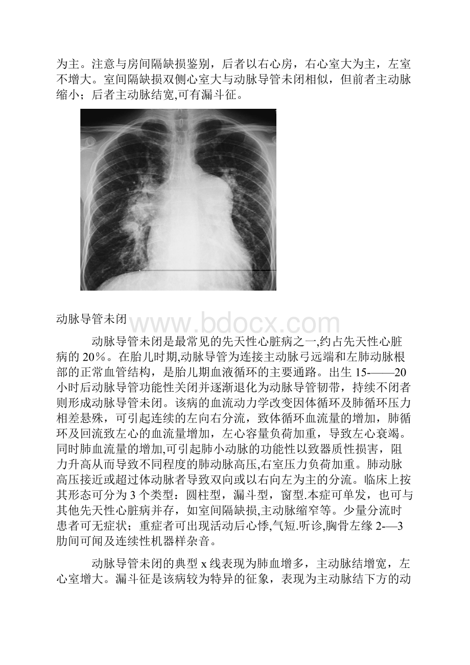 心内科基本技能心脏病X线图像的诊断.docx_第3页