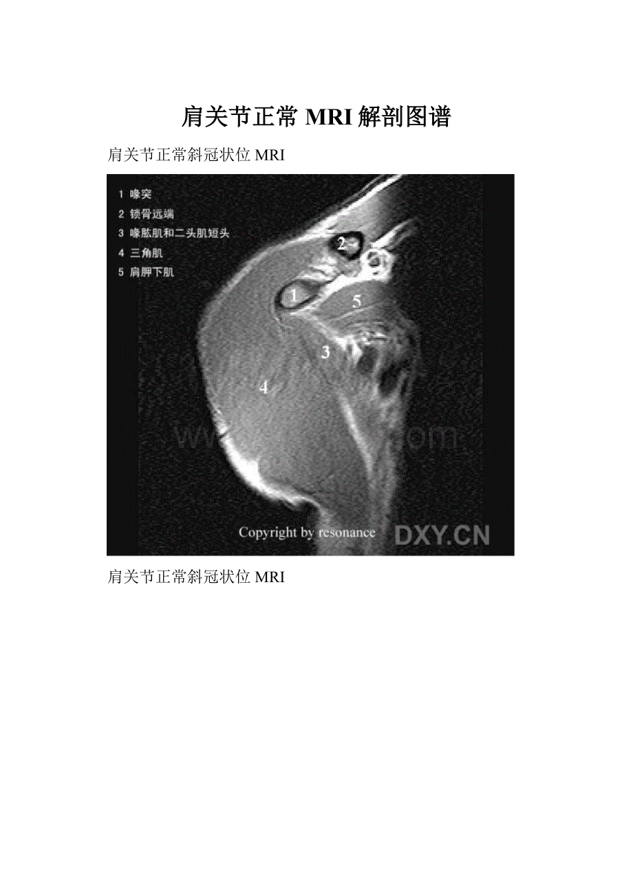 肩关节正常MRI解剖图谱.docx