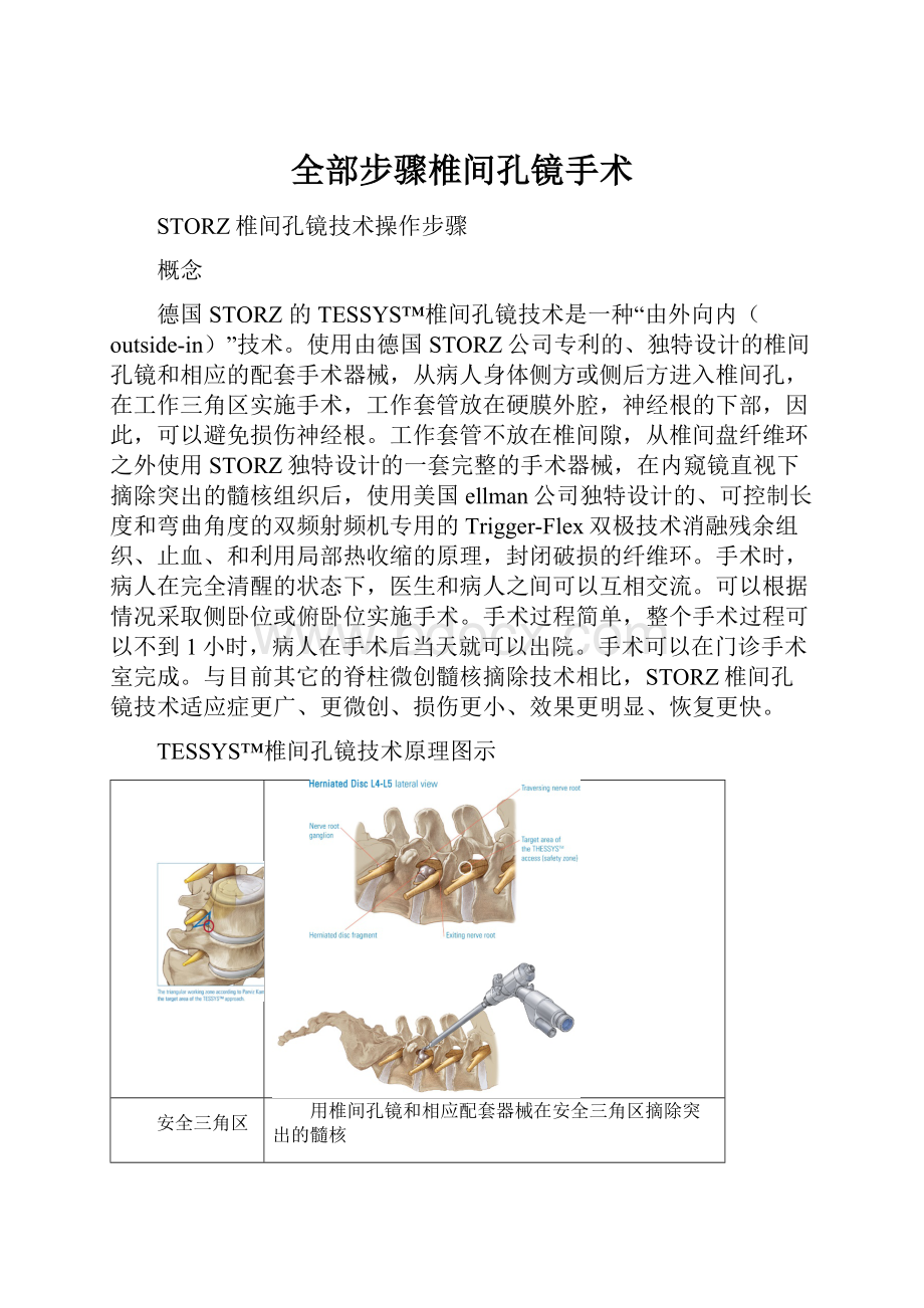 全部步骤椎间孔镜手术.docx_第1页