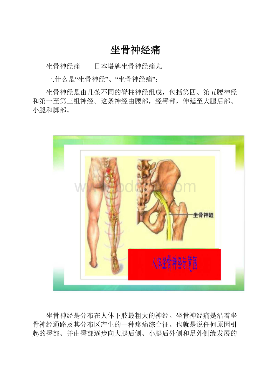 坐骨神经痛.docx_第1页