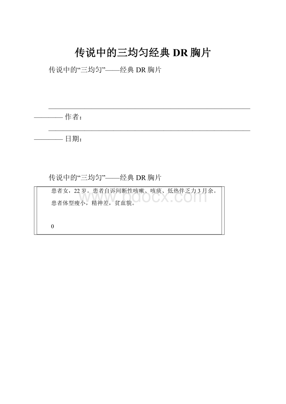 传说中的三均匀经典DR胸片.docx_第1页