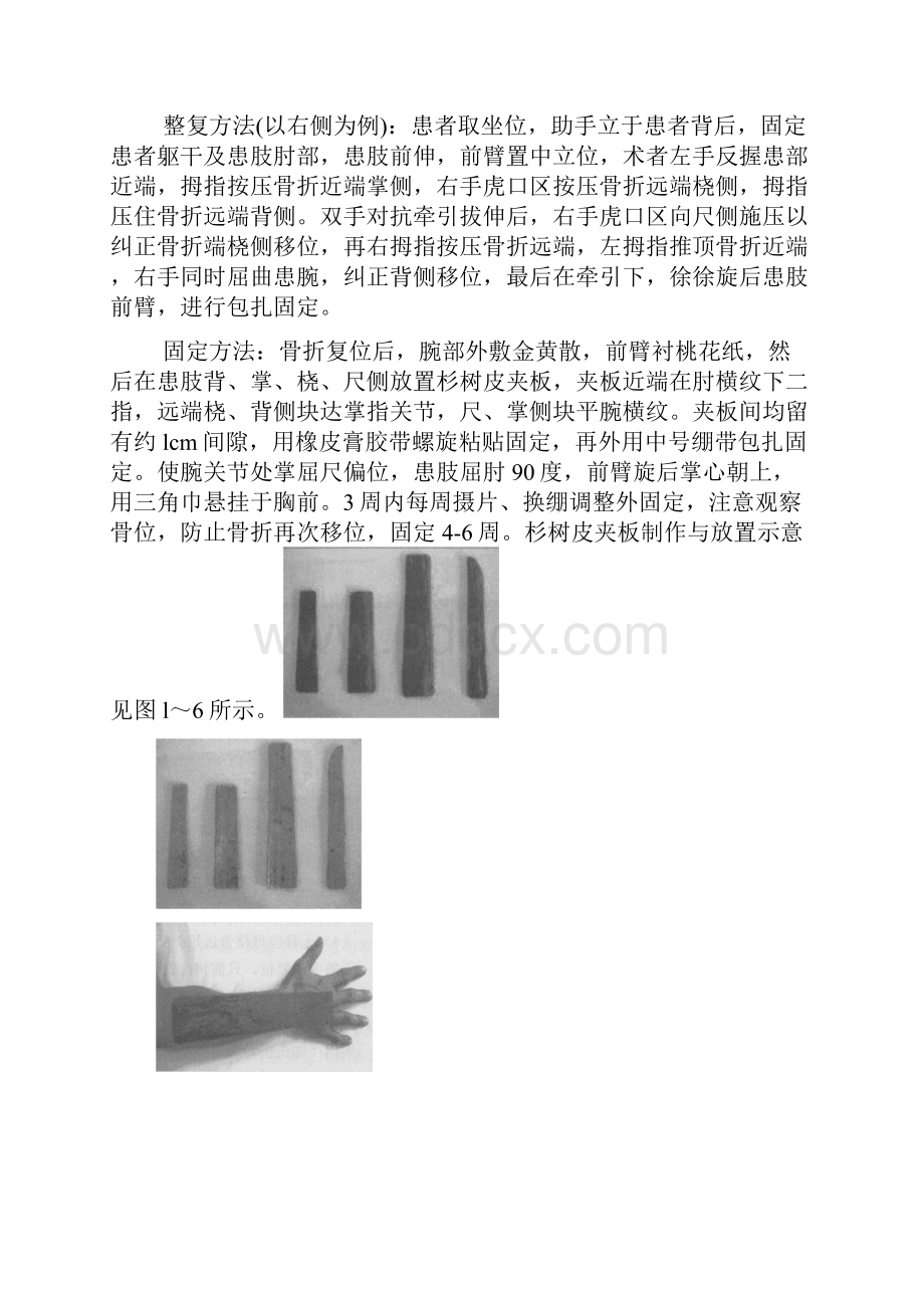 桡骨远端骨折Word文档下载推荐.docx_第3页