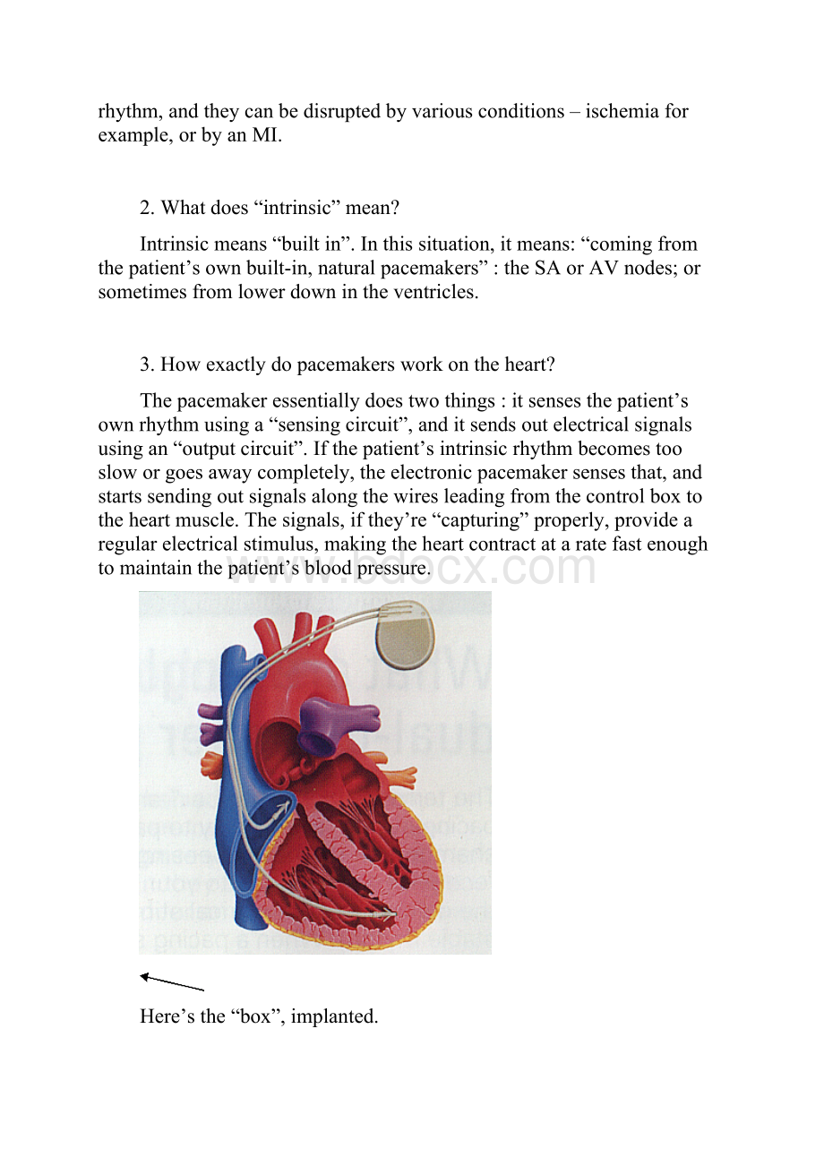 Pacemakers.docx_第3页