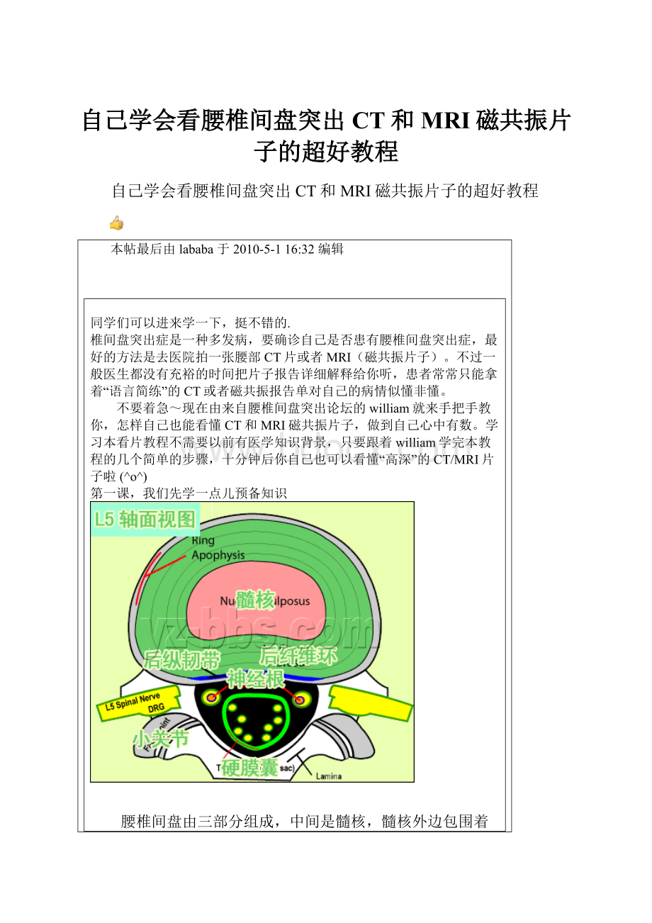 自己学会看腰椎间盘突出CT和MRI磁共振片子的超好教程.docx_第1页