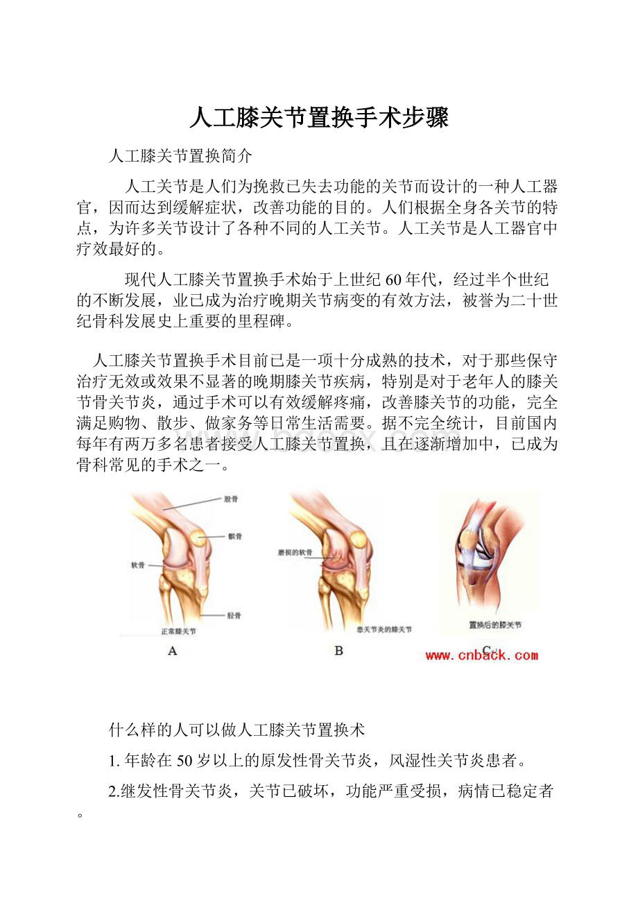人工膝关节置换手术步骤.docx_第1页