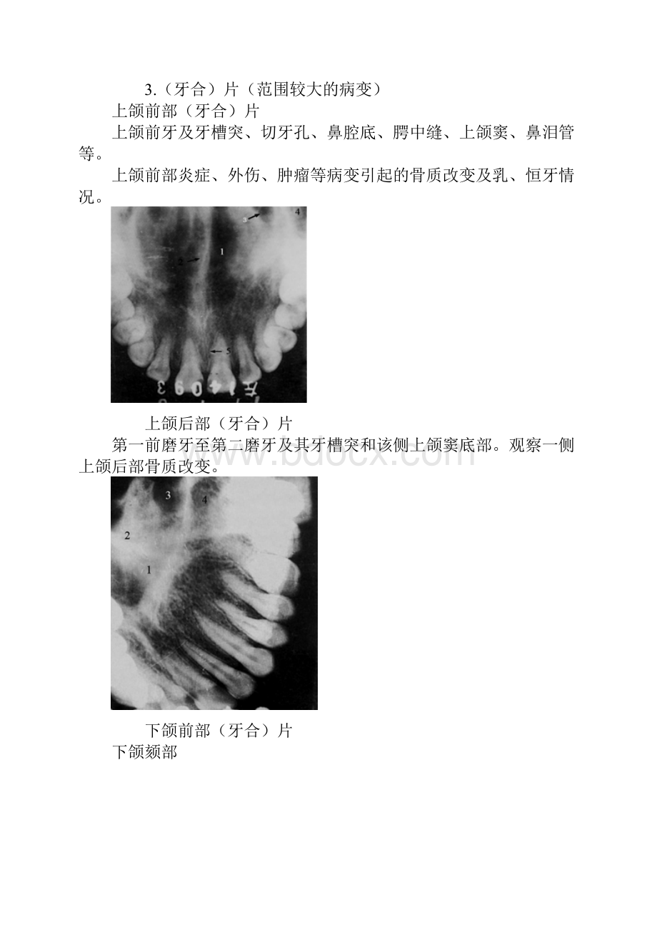 口腔颌面外科学医考讲义口腔颌面部影像学诊断.docx_第2页