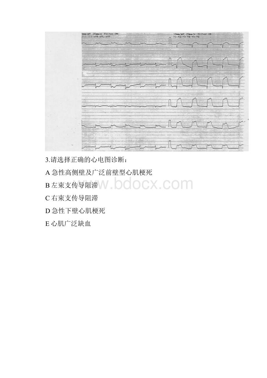 心电图2Word文档下载推荐.docx_第3页