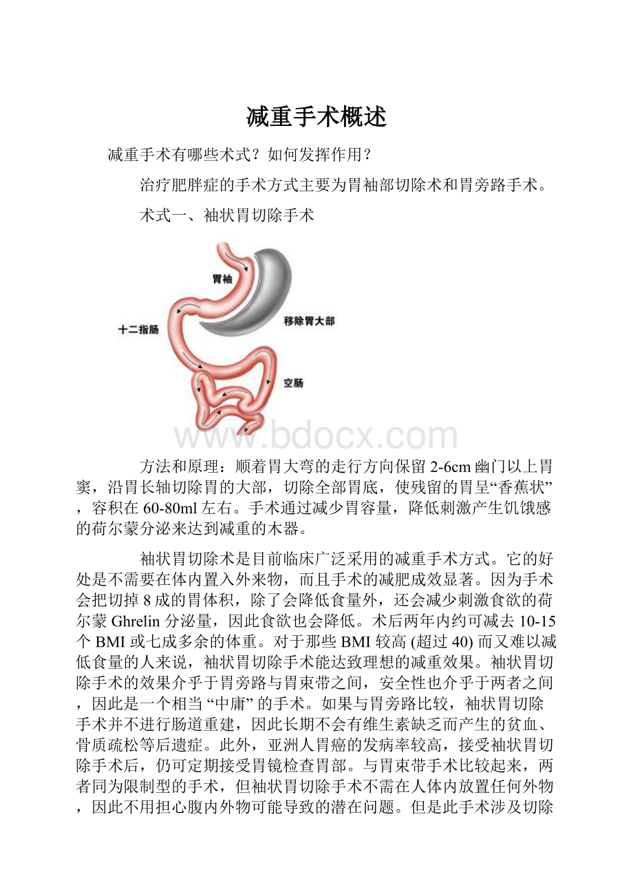 减重手术概述Word格式文档下载.docx