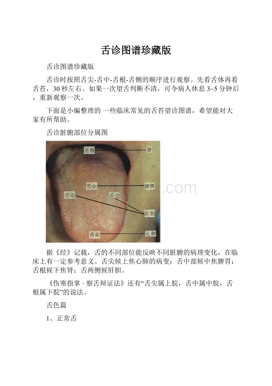 舌诊图谱珍藏版.docx_第1页