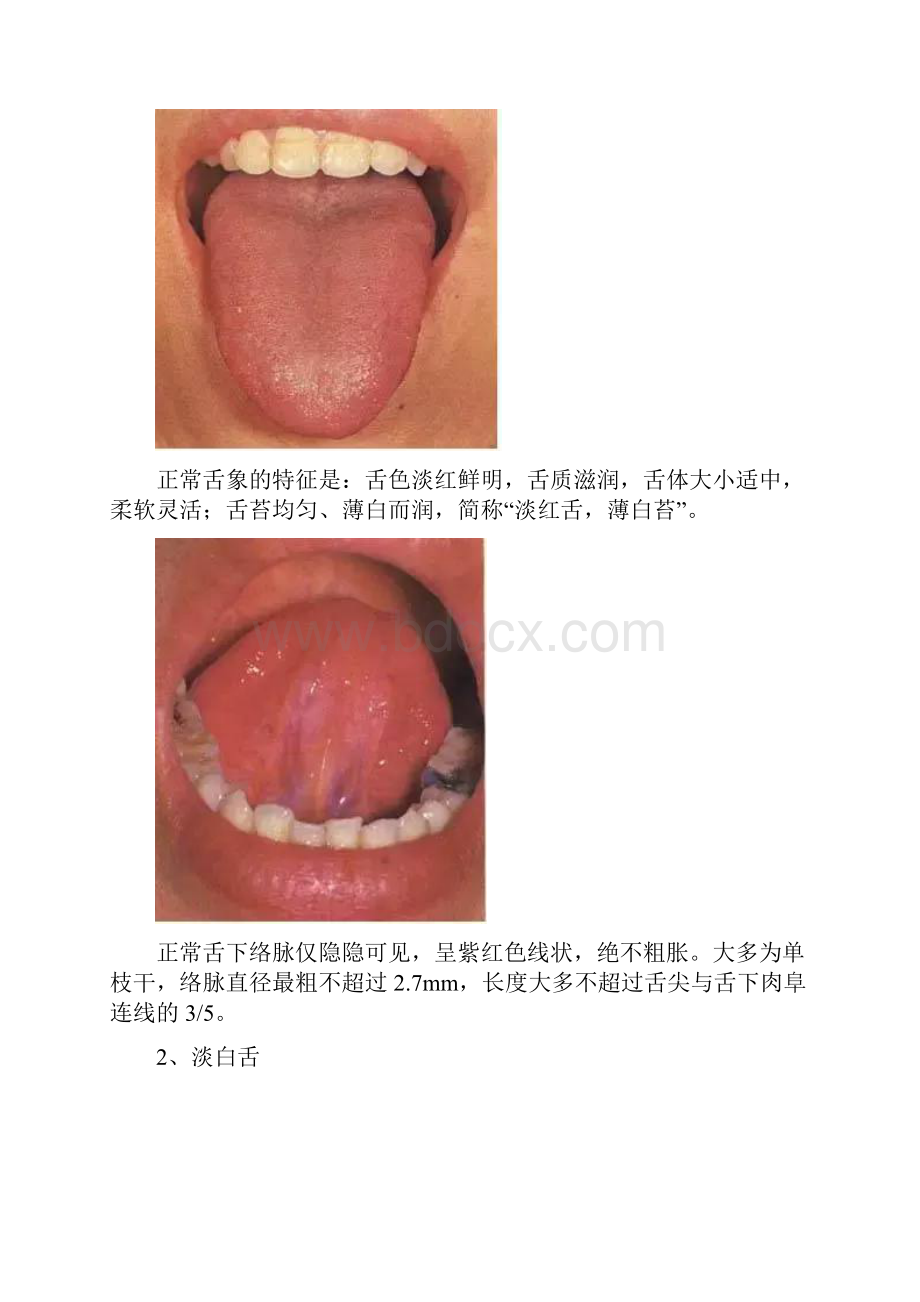 舌诊图谱珍藏版.docx_第2页