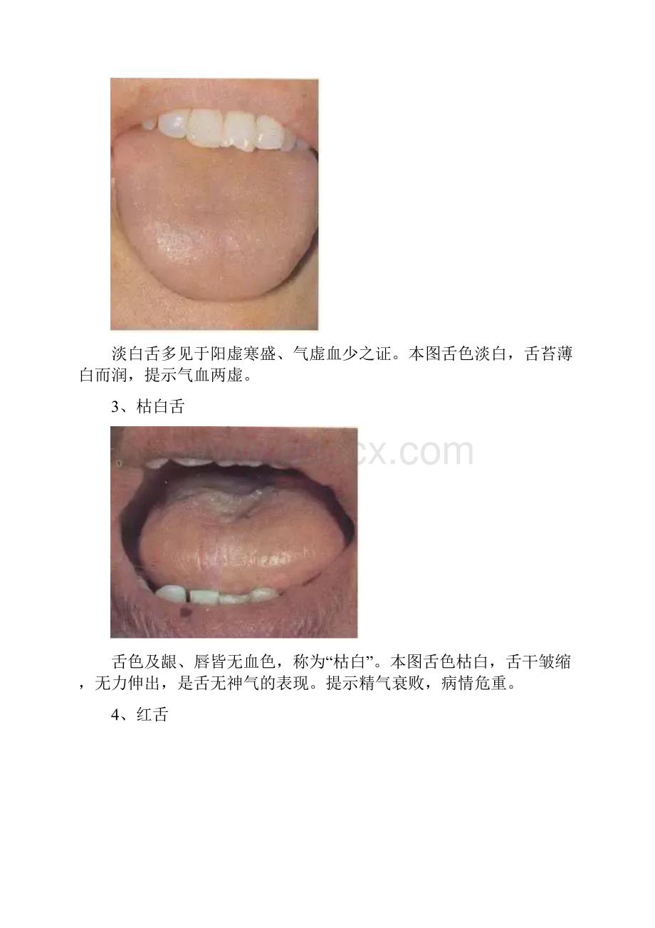 舌诊图谱珍藏版.docx_第3页