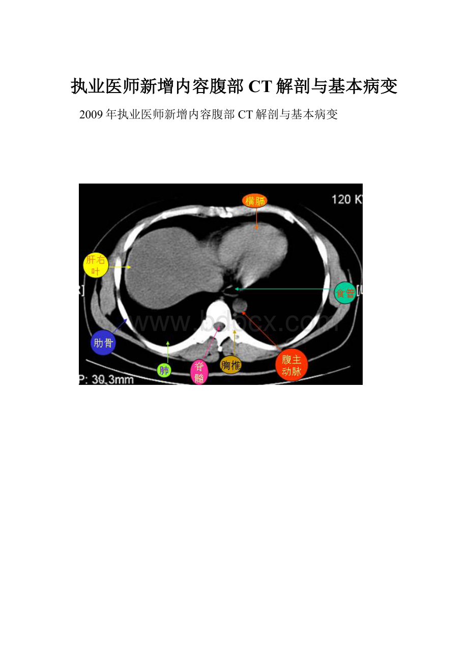 执业医师新增内容腹部CT解剖与基本病变.docx_第1页