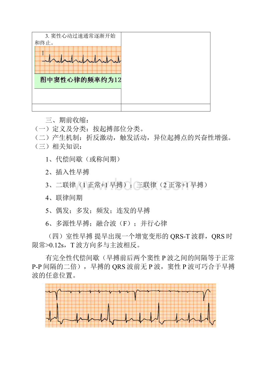 快速心律失常讲座.docx_第2页