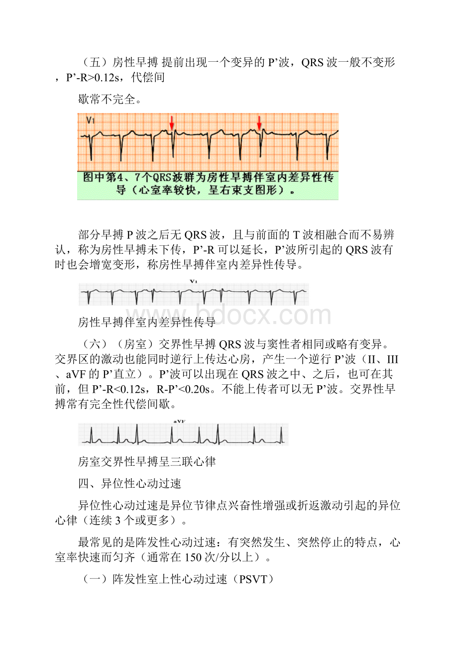 快速心律失常讲座.docx_第3页