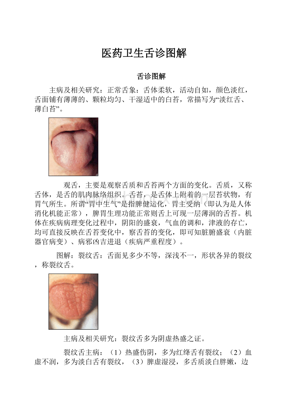 医药卫生舌诊图解.docx