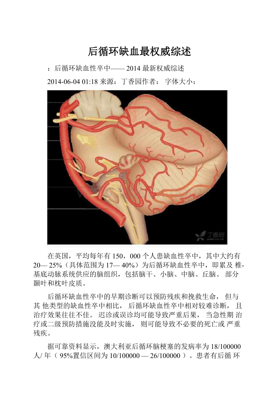 后循环缺血最权威综述.docx_第1页