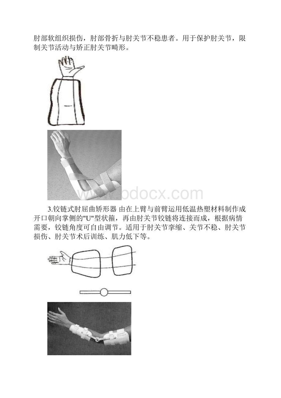 项目九矫形器3常用低温热塑矫形器.docx_第2页