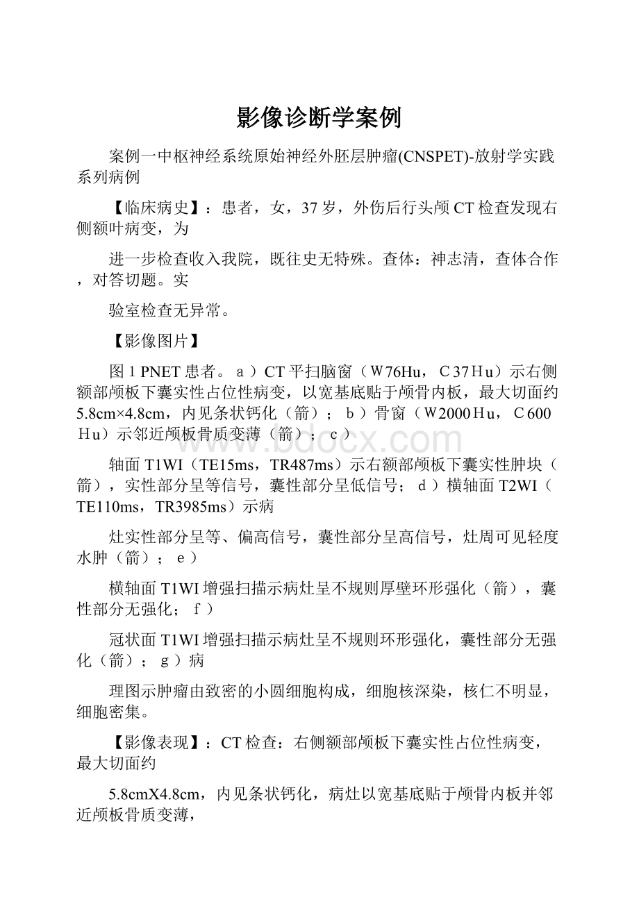 影像诊断学案例.docx_第1页