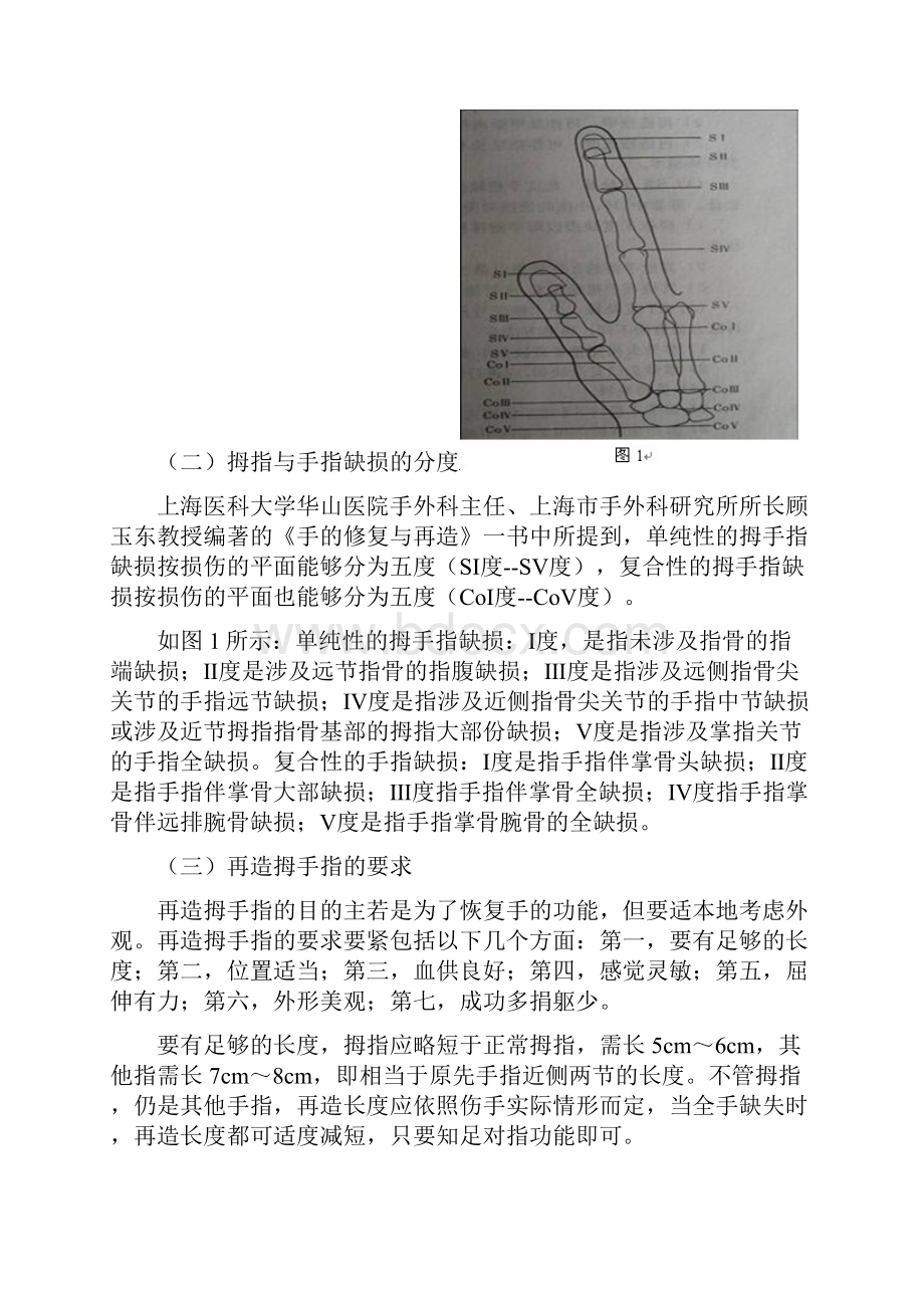 拇指及手指缺损的再造Word文档下载推荐.docx_第2页