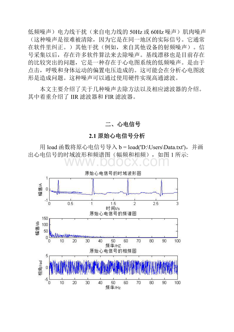 ECG信号分析与处理系统设计剖析.docx_第3页