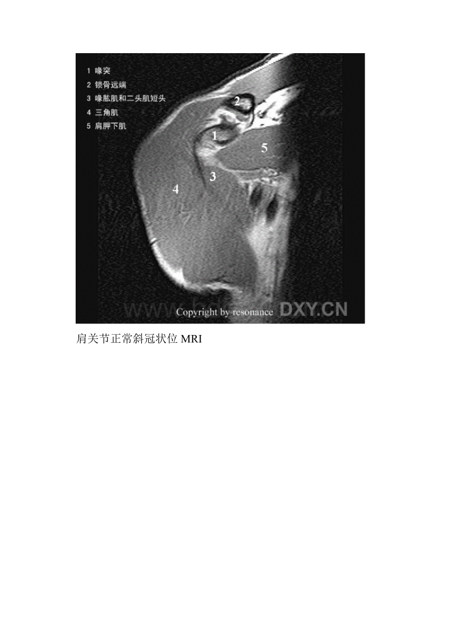 肩关节正常MRI解剖图谱医学参照Word下载.docx_第2页