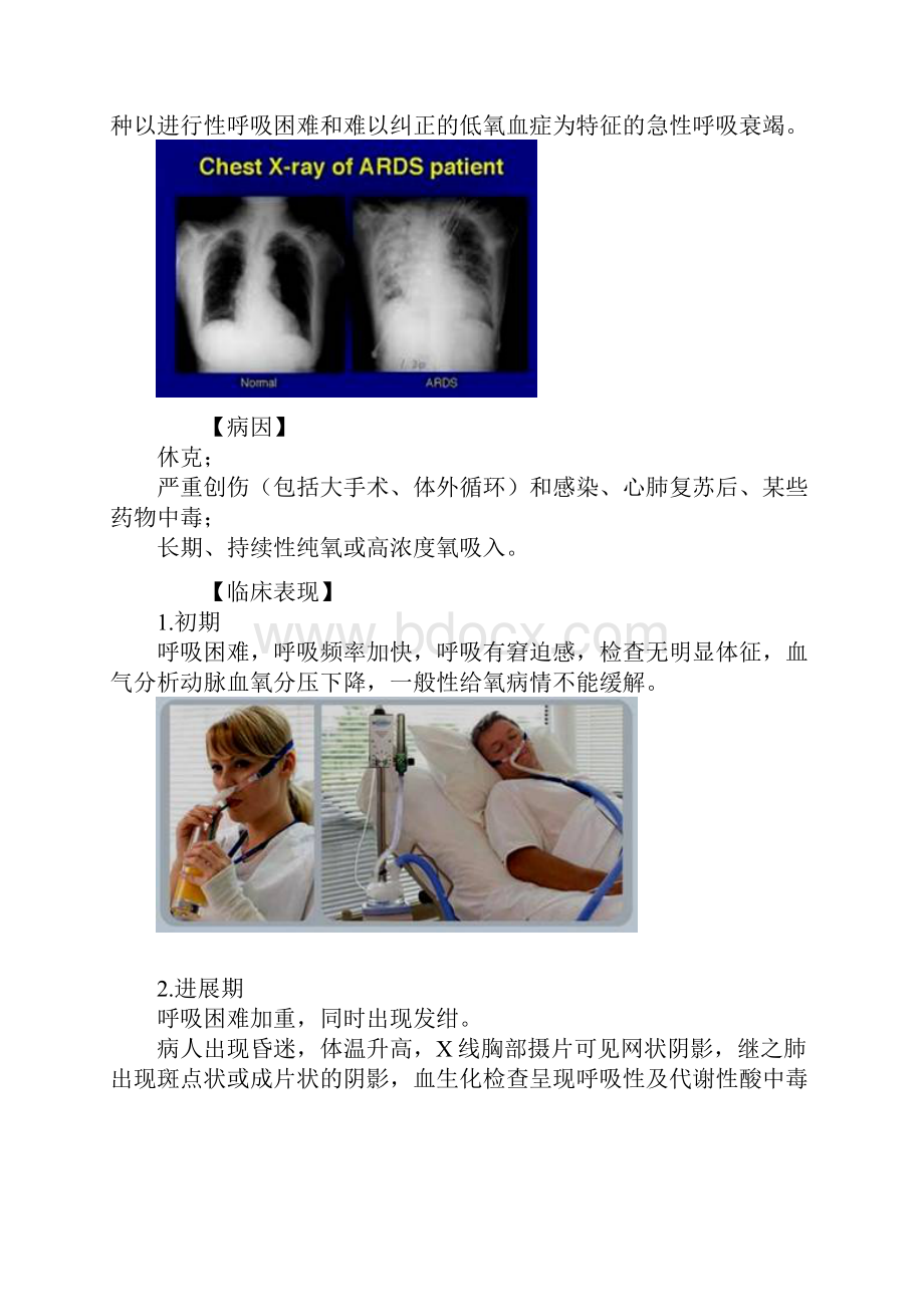 外科护理学图文讲义多器官功能障碍综合征Word文档格式.docx_第2页