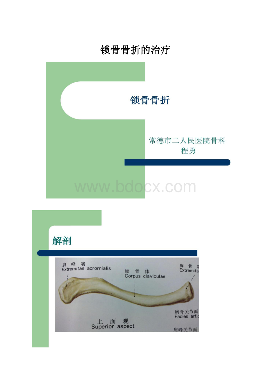 锁骨骨折的治疗.docx_第1页